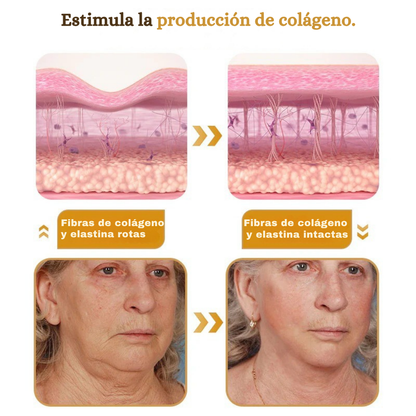 Botox - Crema para eliminar arrugas con Botox y veneno de abeja