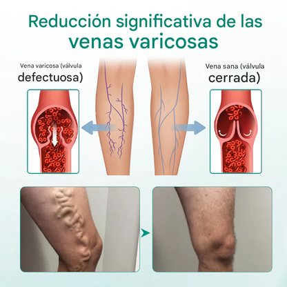 TIMILK  (set x 8) parches para la circulacion y venas varicosas