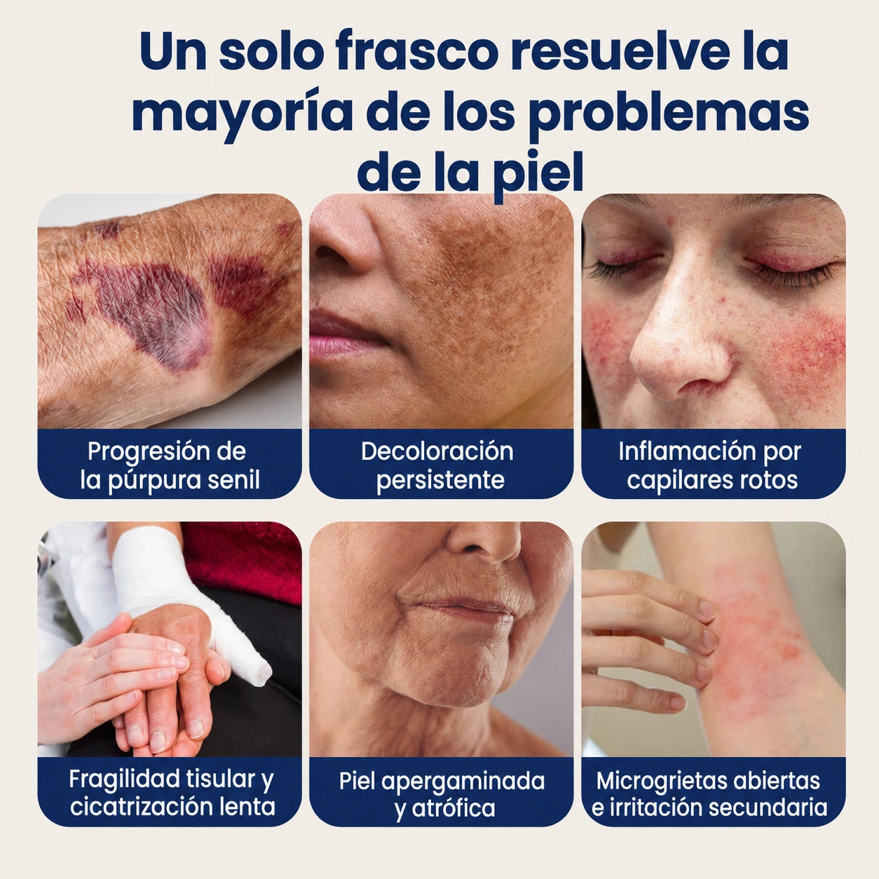 ResiliVeil - Crema protectora para el cuidado de la apariencia de los moretones