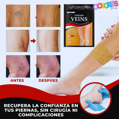 Paga 1 Lleva 3 (36unds) Parches Naturales Para Varices Y Para Las Piernas Cansadas - VeinPatch™