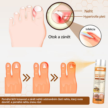 🔥PROMO 2x1🔥 Spray Para Uñas De Veneno De Abeja🐝