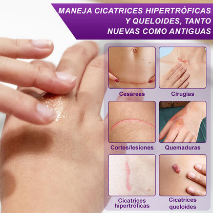 flysmus - Gel Para Cicatrices