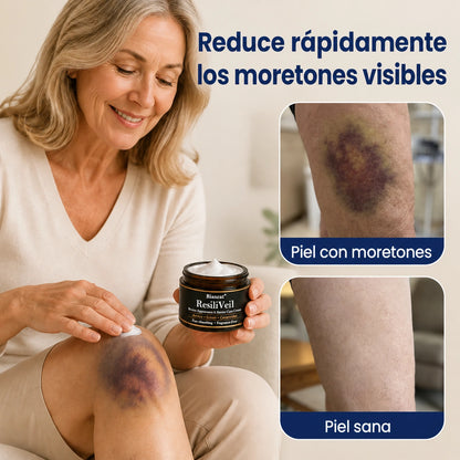 ResiliVeil - Crema protectora para el cuidado de la apariencia de los moretones