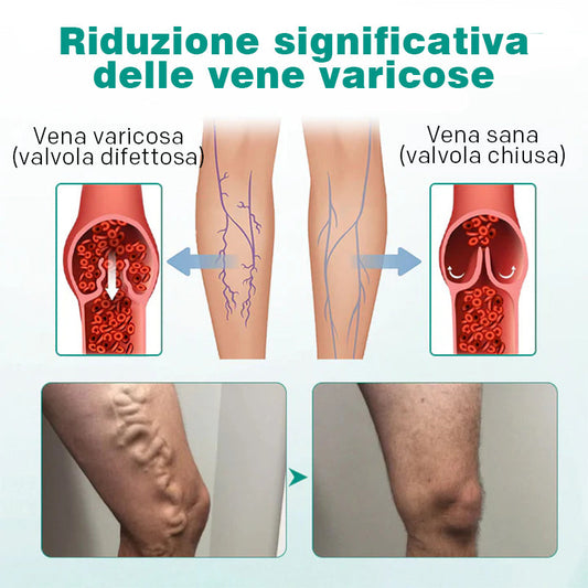 Parche Tópico para Venas Varices (8 PARCHES X PAQUETE)