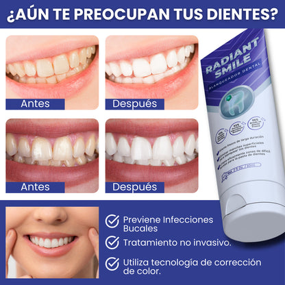 WhiteLuxe™ – Crema Dental Blanqueadora Premium
