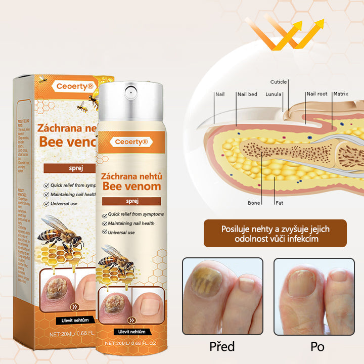 🔥PROMO 2x1🔥 Spray Para Uñas De Veneno De Abeja🐝