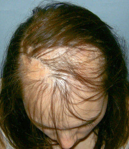 Rodillo Capilar Croaie - STEM Cell Hair Cycle Roller
