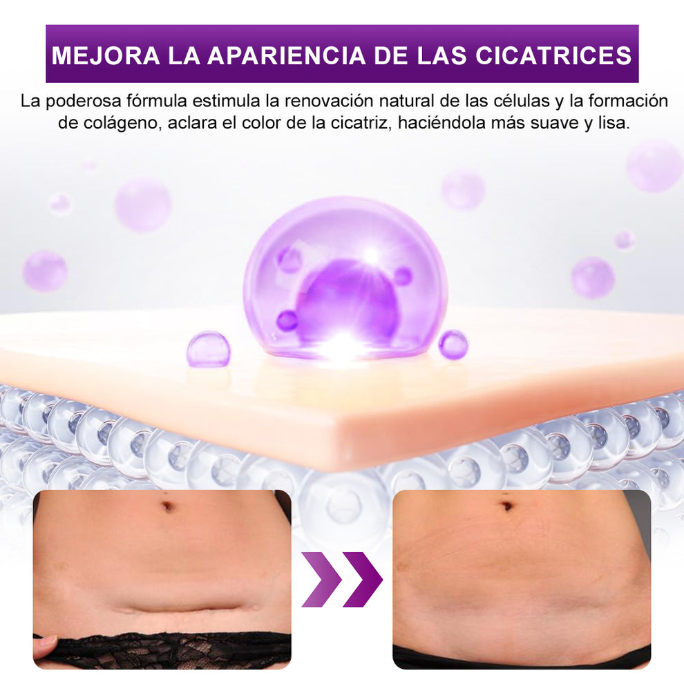 flysmus - Gel Para Cicatrices