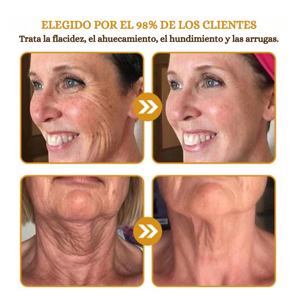 Botox - Crema para eliminar arrugas con Botox y veneno de abeja