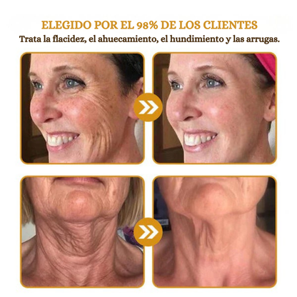 Botox - Crema para eliminar arrugas con Botox y veneno de abeja