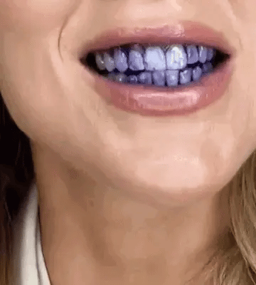 PURPLE V34 - Blanqueador Dental