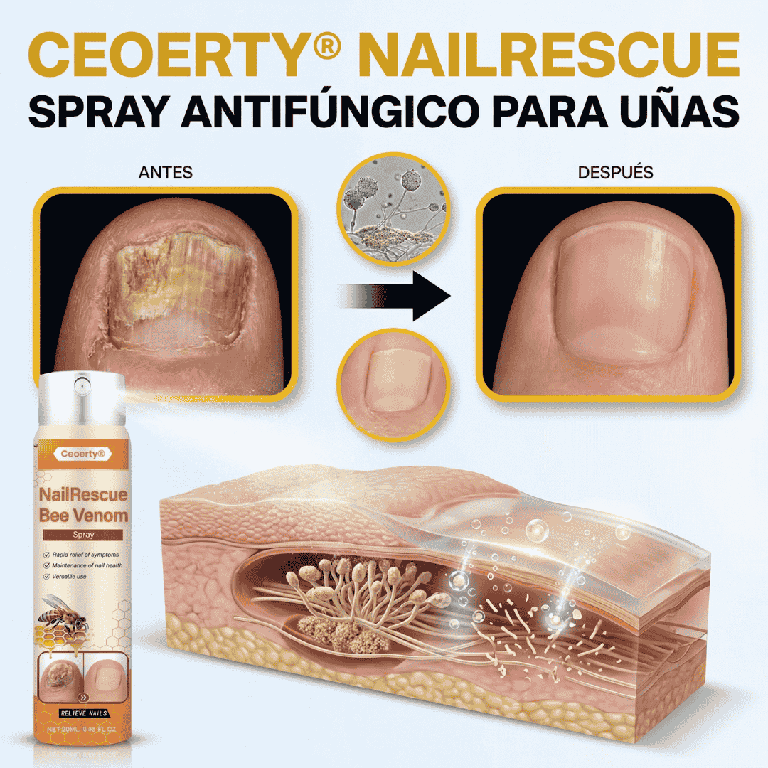 ¡PROMO 2X1! Ceoerty - Spray de veneno de abeja