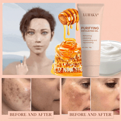 Luhaka® Gel Exfoliante Purificante ACE 3 Para Acantosis Nigricans, Exfoliación, Manchas Oscuras, Acrocordones y Eczema