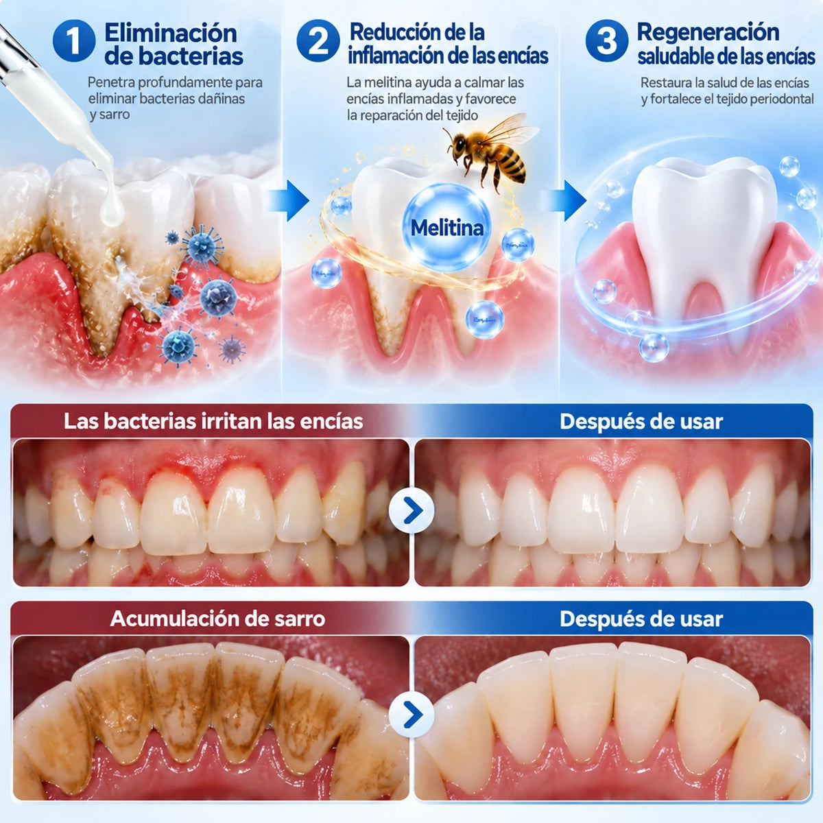 PerioCore - Suero periodontal con veneno de abeja