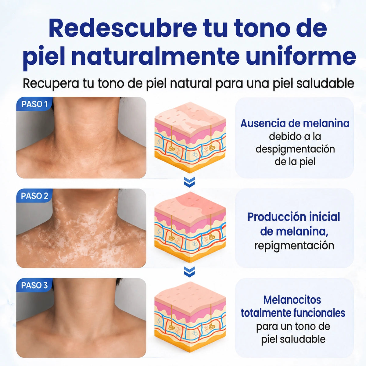 VitiRepair - Spray avanzado para el vitiligo y parches blancos