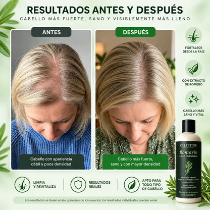 Celestine - Shampoo De Romero Y Queratina