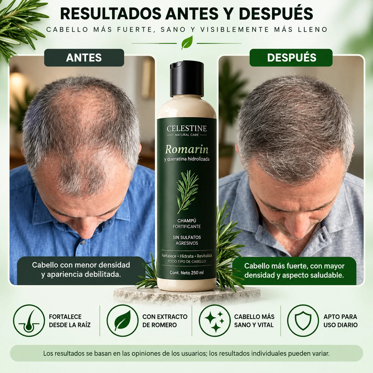 Celestine - Shampoo De Romero Y Queratina