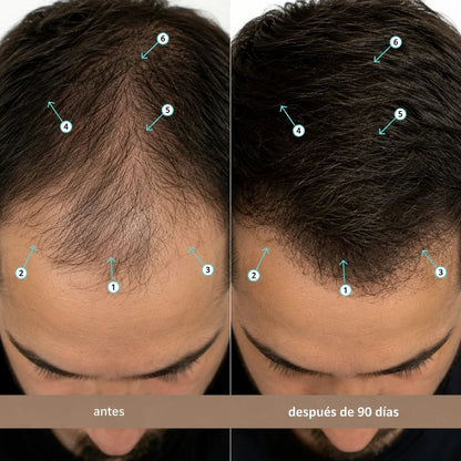 Sérum Avanzado De Densidad Capilar Con Nanoxidil 5%