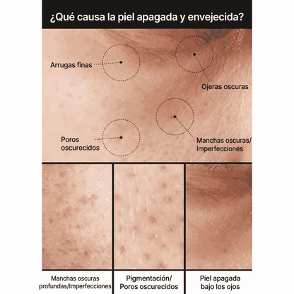 Crema aclaradora de poros y manchas oscuras