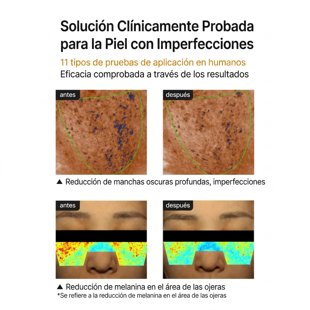 Crema aclaradora de poros y manchas oscuras