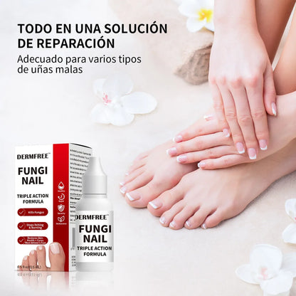 Fungi Nail ™ – Tratamiento Para El Cuidado De Uñas