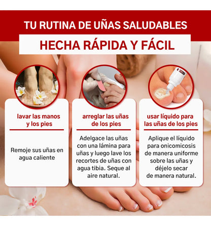 Fungi Nail ™ – Tratamiento Para El Cuidado De Uñas