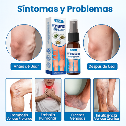 VeinGuard: Elimina las varices rápidamente