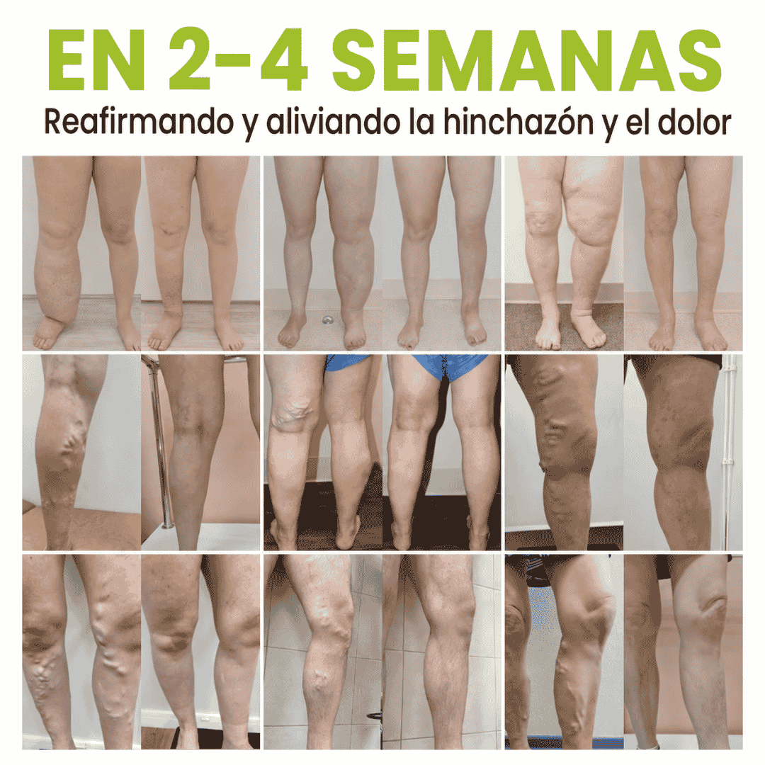 Crema Profesional para la Circulación de Piernas