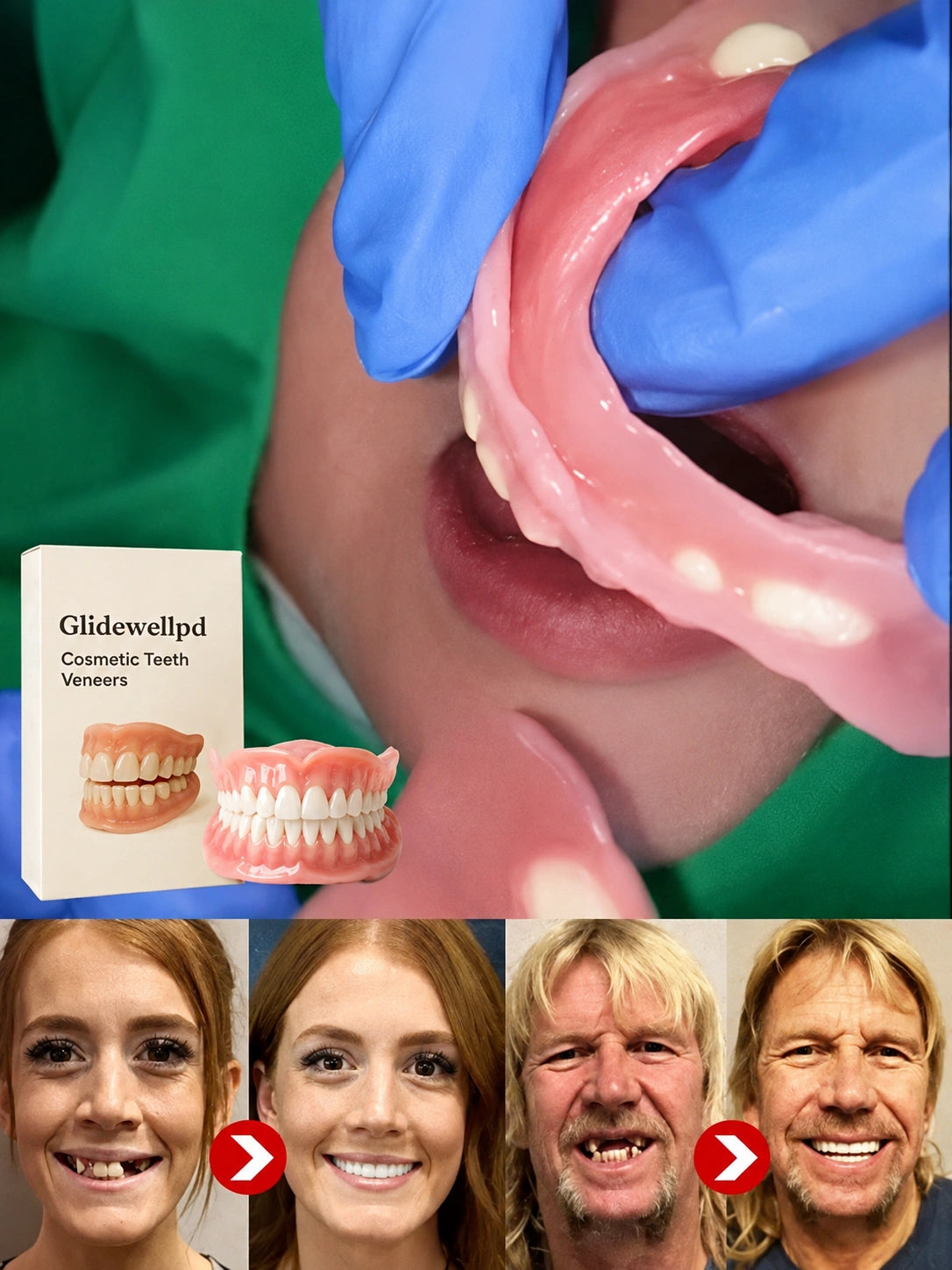 🔝Mejora épica🔝Prótesis Dentales de Cobertura Total Premium (Superior + Inferior)