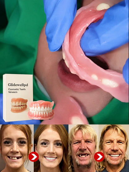 🔝Mejora épica🔝Prótesis Dentales de Cobertura Total Premium (Superior + Inferior)