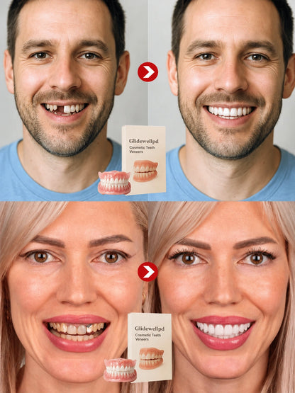 🔝Mejora épica🔝Prótesis Dentales de Cobertura Total Premium (Superior + Inferior)
