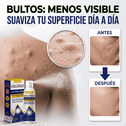 Spray Removedor De Imperfecciones  - ChillErase