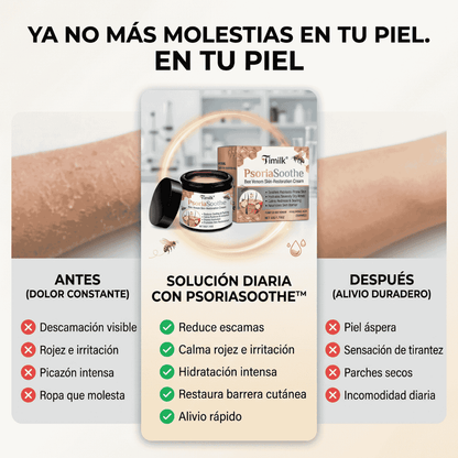 Crema Reparadora Para La Piel - PsoriaSoothe Con Veneno De Abeja