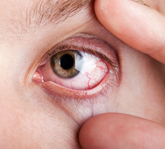 Gotas Oftalmológicas Para La Restauración De La Visión