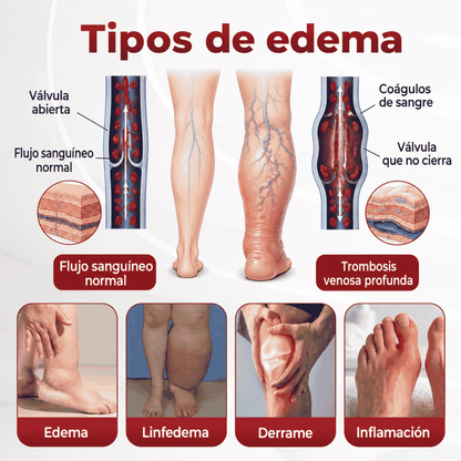 SwellVeil - Crema para la circulación de piernas