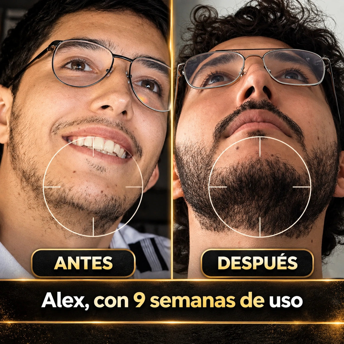 🧔🏻Bálsamo Estimulante De Barba Apolo + Activador : Barba más densa, fuerte y saludable🧴