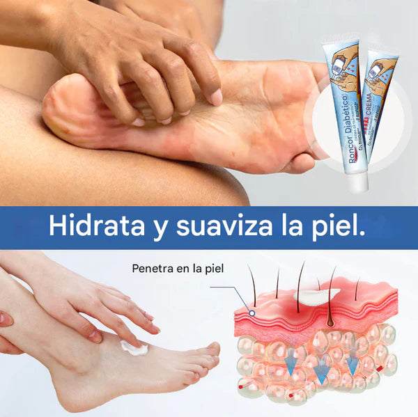 Biancat™ VitaGluco Crema para el tratamiento de la diabetes