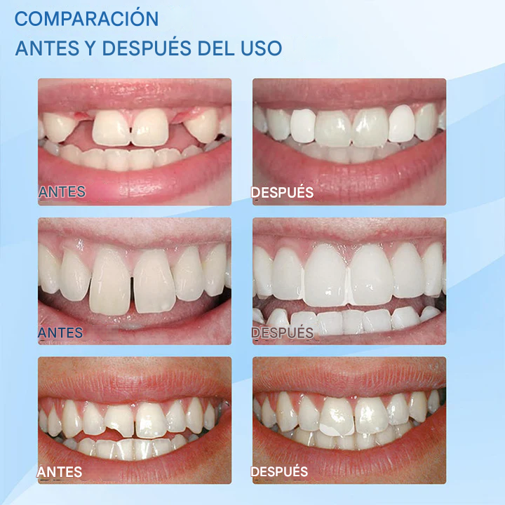 Kit de Reparación Dental Profesional