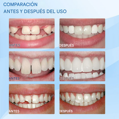 Kit de Reparación Dental Profesional