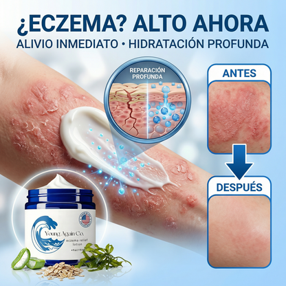 Young AgainCO® crema💧 aliviante dermatologica👩‍⚕️ de eczema