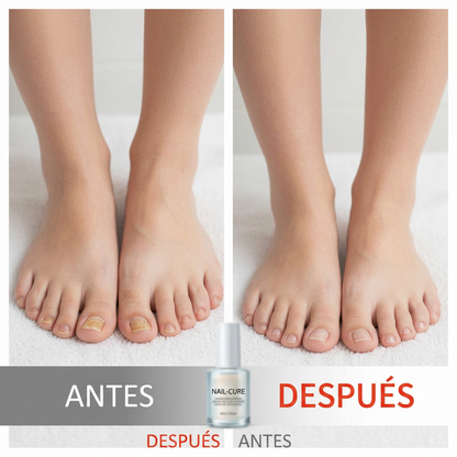 Esencia reparadora para uñas dañadas💅🏻