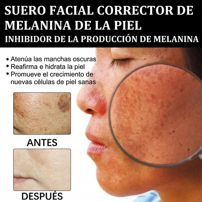Brightening Serum - Sérum iluminador con niacinamida ✨