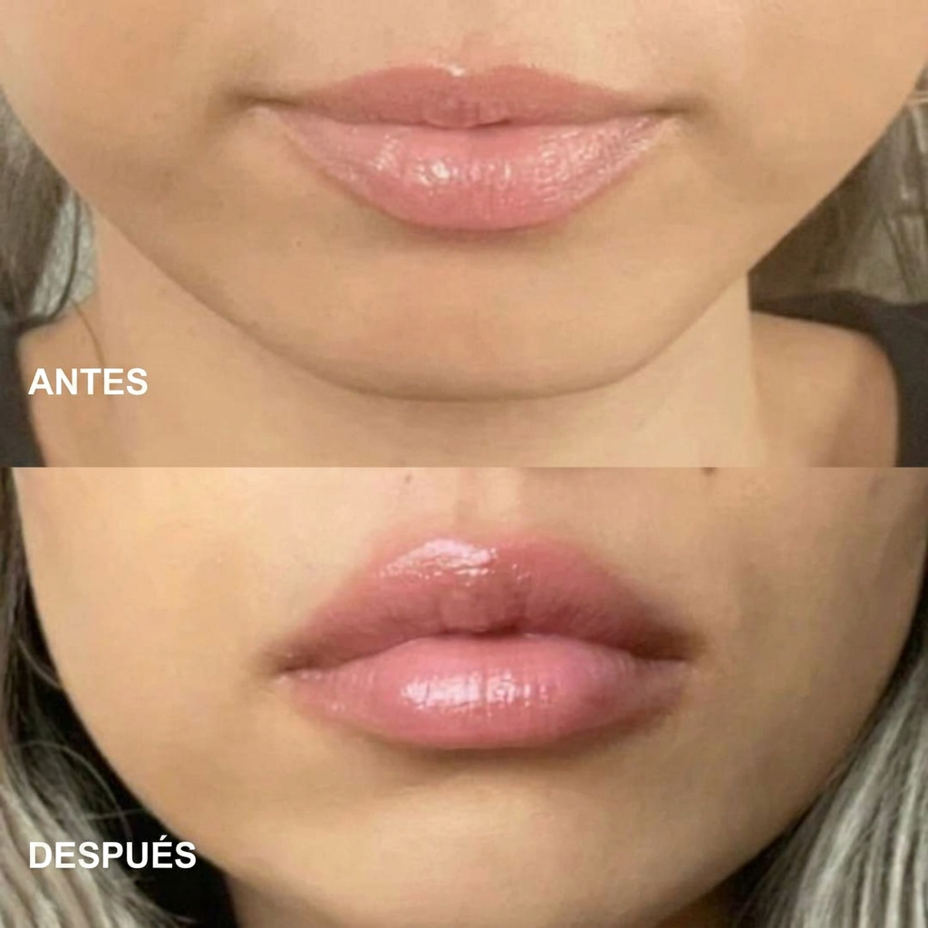 LIP PLUMPER - MÁXIMA VOLUMINIZACIÓN