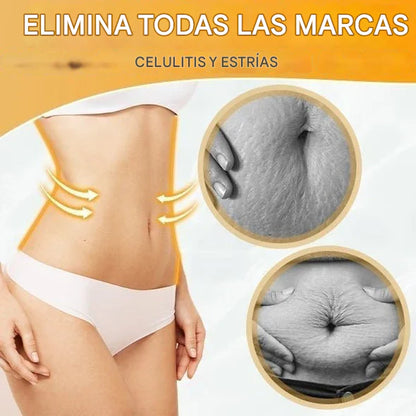 BURN® - Aceite Quemador De Grasa + Reafirmante + Drenaje Linfático