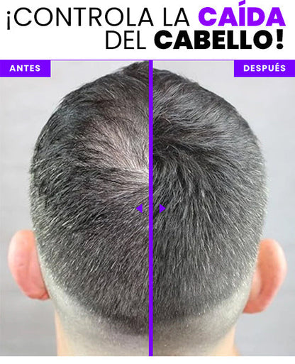 Bunee Pro™ - Eliminador De Canas Y Raíces