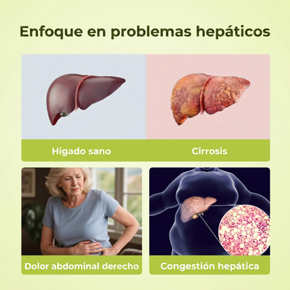 Oxyenergy Cardo Mariano Desintoxicante para el Hígado - YTY5