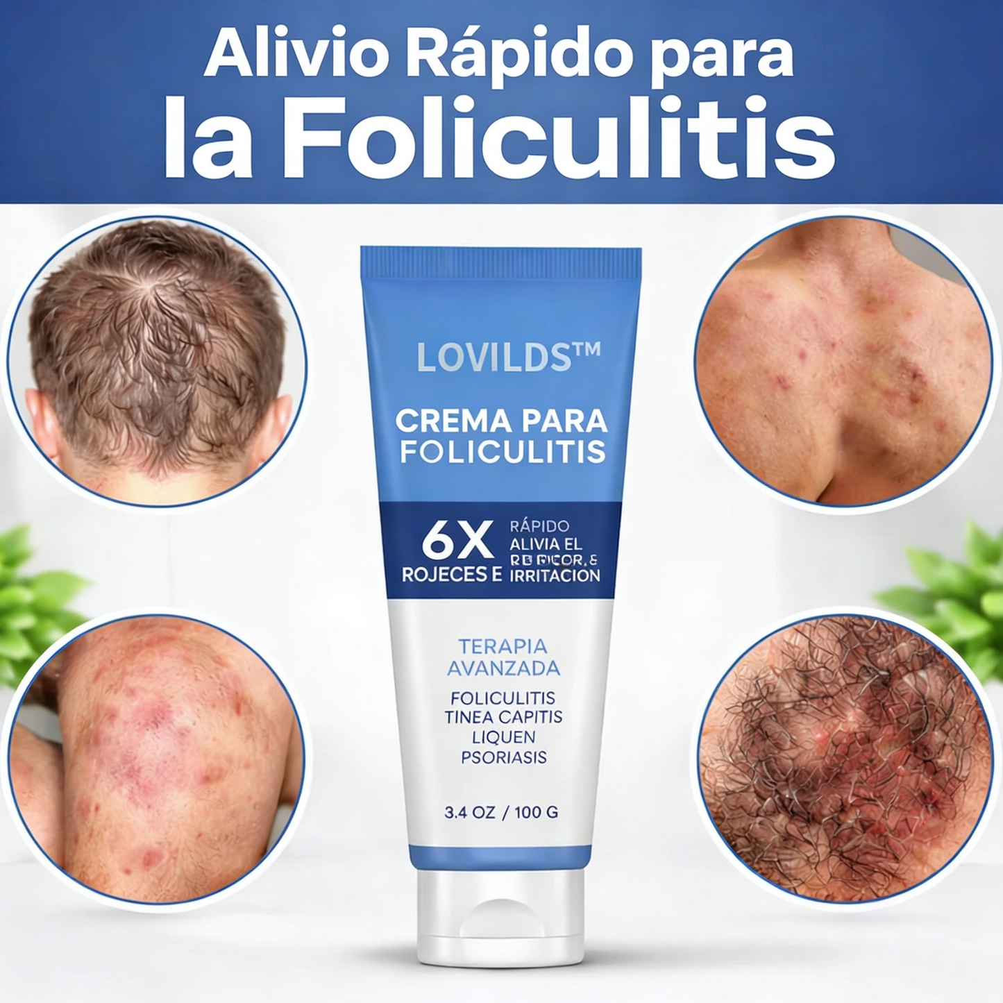 Crema para la foliculitis, alivio de la picazón, calma el enrojecimiento y la irritación, tratamiento avanzado, aprobado por dermatólogos