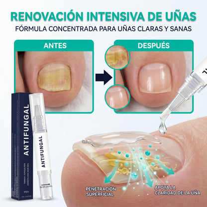 Lápiz renovador de uñas: revitaliza las uñas opacas y dañadas. (Pack x3, x6, x9)