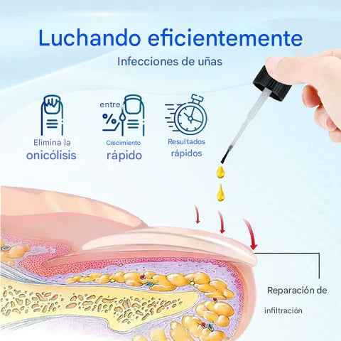 🔥Biancat™ OnyxoGuard🔥- Suero para el crecimiento, hongos y la reparación de uñas