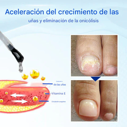 🔥 (Paga 1 Lleva 2 ) Suero para el crecimiento y la reparación de uñas Biancat™ OnyxoGuard🔥